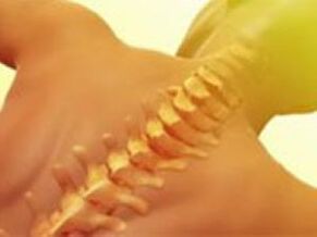 Osteochondrosis - Arun Spine