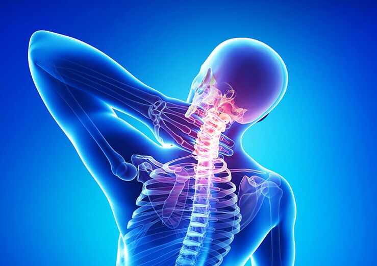 Osteochondrosis ti ọpa ẹhin jẹ aisan ti o ni ipa lori kerekere articular ati vertebrae.