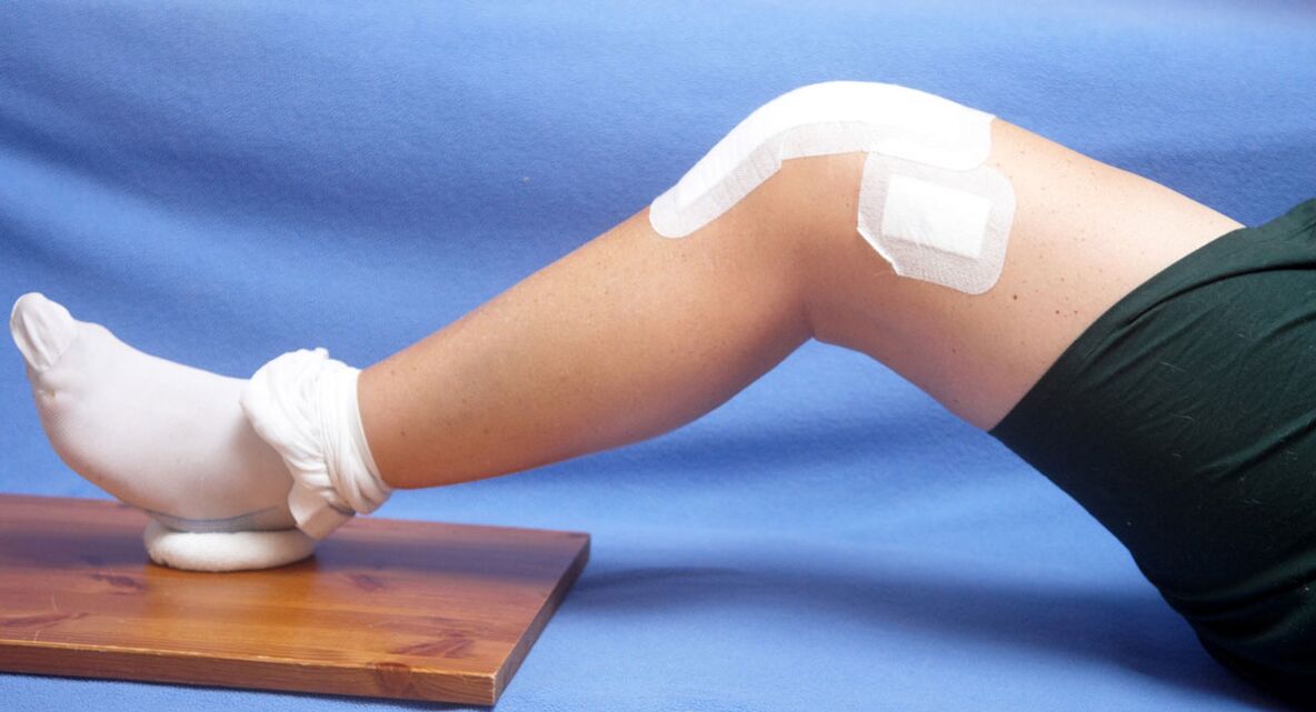 arthrosis ti itọju apapọ orokun